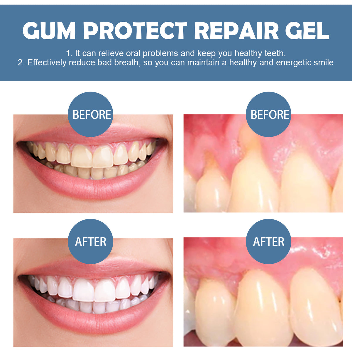 🦷✨ Gum Protect Repair Gel – Restore Healthy Gums & Smile With Confidence!